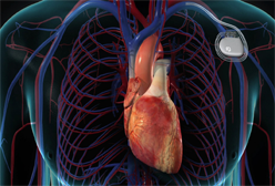 Device Implantation